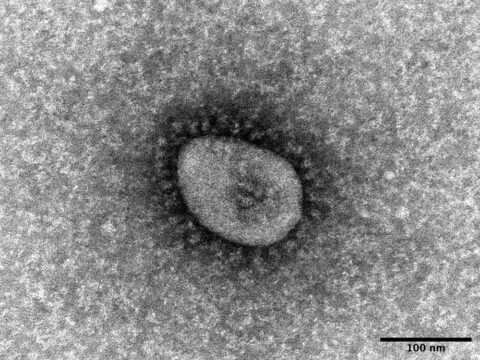 三重県でオミクロン株初確認　米国から帰国の四日市市の患者1人　新型コロナ