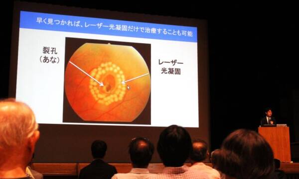 目の健康と街のにぎわいテーマに市民公開セミナー、四日市で三重大学